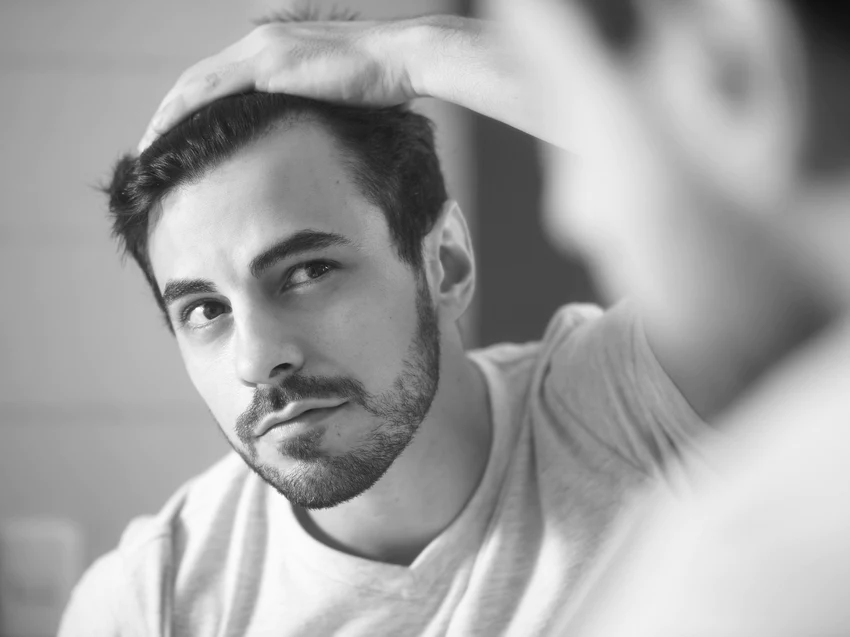 So wirkt Minoxidil: Vorher und Nachher