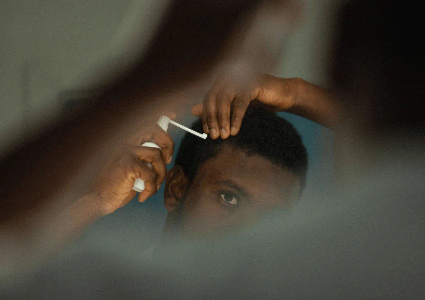 Minoxidil gegen Haarausfall: Wirksamkeit und Anwendung im Überblick